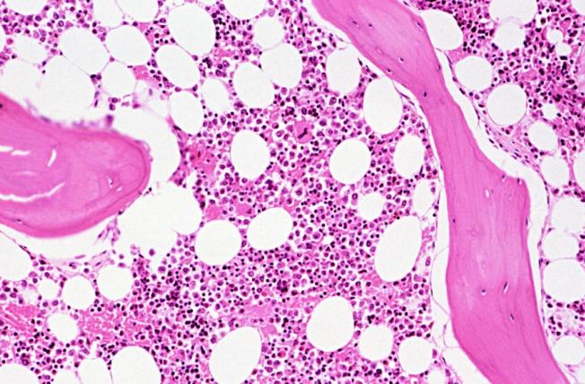 bone marrow microscopic view